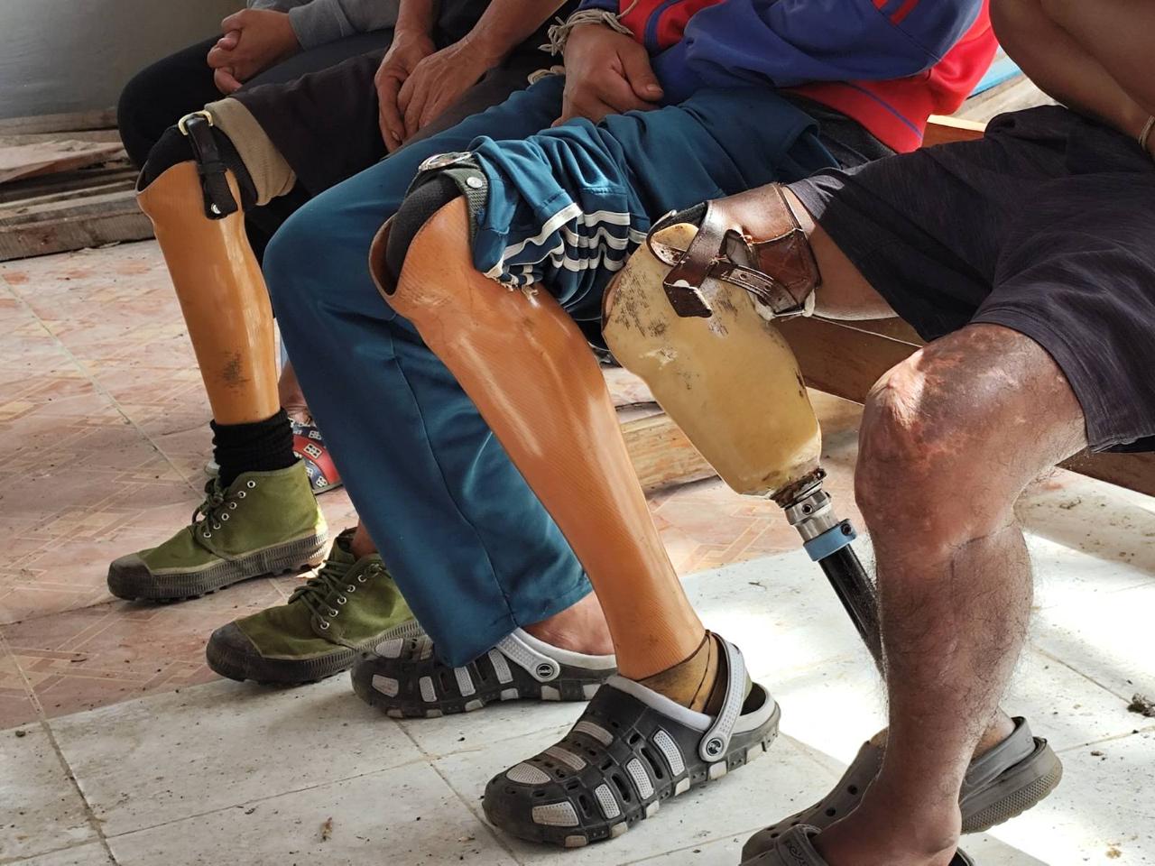 Three men with prosthetic legs seated on a bench in a modest indoor recovery setting.